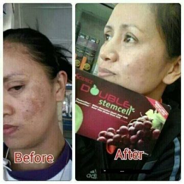 phytoscience-double-stemcell